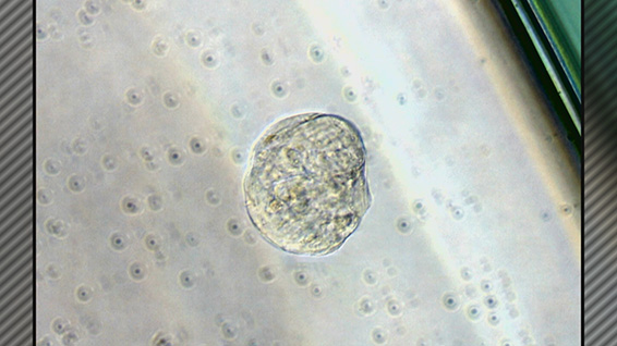 Ｍｕｓｅ細胞“脳性まひ”でも治験開始